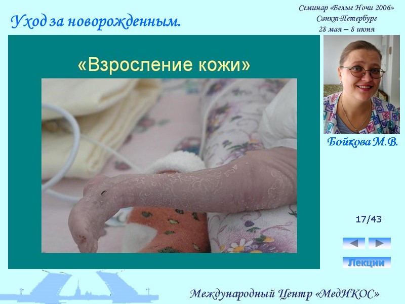 17/43 Лекции Уход за новорожденным. Бойкова М.В.